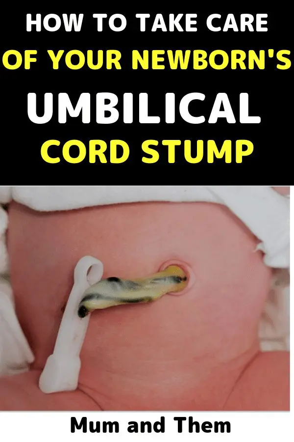 umbilical cord stump